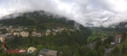 Archiv Foto Webcam Bad Gastein - Hotel Schillerhof 10:00