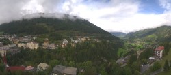 Archiv Foto Webcam Bad Gastein - Hotel Schillerhof 11:00