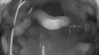 Archiv Foto Webcam Skigebiet Beitostolen: Raudalen 05:00