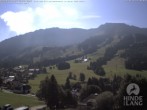Archived image Webcam Kids hotel Oberjoch 09:00
