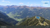 Archived image Webcam Dorgastein Ski Resort: Fulseck 10:00